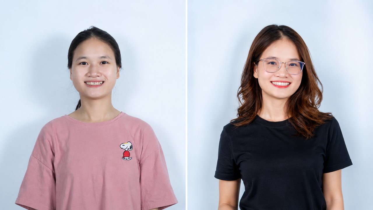 Khách hàng trước và sau khi niềng răng tại Nha khoa Hân Đào